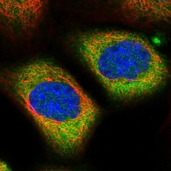 ALMS1 Polyclonal Antibody:Antibodies, Polyclonal