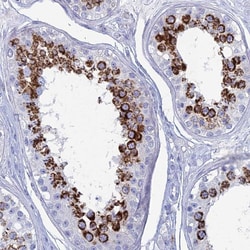 ALMS1 Polyclonal Antibody:Antibodies, Polyclonal