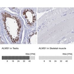 ALMS1 Polyclonal Antibody:Antibodies, Polyclonal
