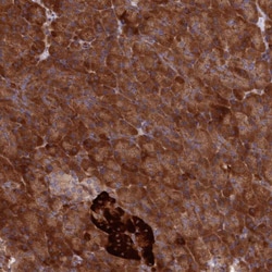 Invitrogen DDX60L Polyclonal Antibody 100 &mu;L; Unconjugated:Antibodies,