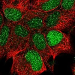 Invitrogen CCDC106 Polyclonal Antibody 100 &mu;L; Unconjugated:Antibodies,