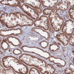 Invitrogen CCDC106 Polyclonal Antibody 100 &mu;L; Unconjugated:Antibodies,