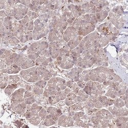 Invitrogen NEK3 Polyclonal Antibody 100 &mu;L; Unconjugated:Antibodies,