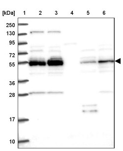 Invitrogen NEK3 Polyclonal Antibody 100 &mu;L; Unconjugated:Antibodies,