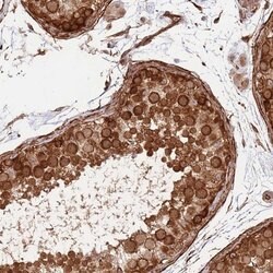 Invitrogen NEK3 Polyclonal Antibody 100 &mu;L; Unconjugated:Antibodies,