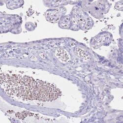 Invitrogen HBB Polyclonal Antibody 100 &mu;L; Unconjugated:Antibodies,