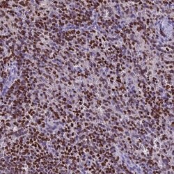 Invitrogen AKAP17A Polyclonal Antibody 100 &mu;L | Buy Online | Invitrogen&trade; | Fisher Scientific