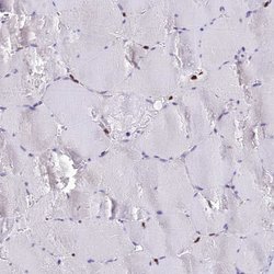 Invitrogen AKAP17A Polyclonal Antibody 100 &mu;L | Buy Online | Invitrogen&trade; | Fisher Scientific