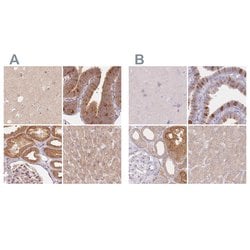 Invitrogen WDR54 Polyclonal Antibody 100 &mu;L; Unconjugated:Antibodies,