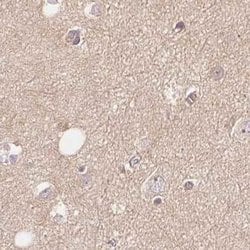 Invitrogen WDR54 Polyclonal Antibody 100 &mu;L; Unconjugated:Antibodies,
