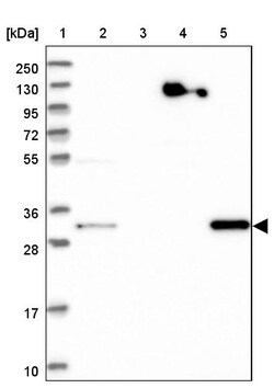Invitrogen WDR54 Polyclonal Antibody 100 &mu;L; Unconjugated:Antibodies,