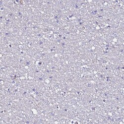 Invitrogen POTEE Polyclonal Antibody 100 &mu;L; Unconjugated:Antibodies,