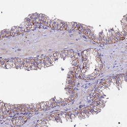 Invitrogen POTEE Polyclonal Antibody 100 &mu;L; Unconjugated:Antibodies,