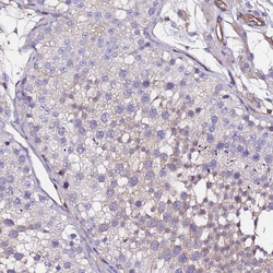 Invitrogen POTEE Polyclonal Antibody 100 &mu;L; Unconjugated:Antibodies,
