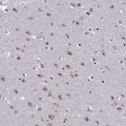 Invitrogen PPAN Polyclonal Antibody 100 &mu;L; Unconjugated:Antibodies,