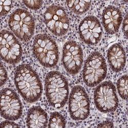 Invitrogen PPAN Polyclonal Antibody 100 &mu;L; Unconjugated:Antibodies,