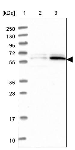 Invitrogen PPAN Polyclonal Antibody 100 &mu;L | Buy Online | Invitrogen&trade; | Fisher Scientific
