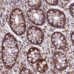 Invitrogen PPP1R11 Polyclonal Antibody 100 &mu;L; Unconjugated:Antibodies,