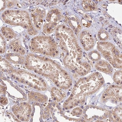 Invitrogen PPP1R11 Polyclonal Antibody 100 &mu;L; Unconjugated:Antibodies,
