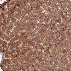 Invitrogen PPP1R11 Polyclonal Antibody 100 &mu;L; Unconjugated:Antibodies,