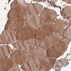 Invitrogen PPP1R11 Polyclonal Antibody 100 &mu;L; Unconjugated:Antibodies,