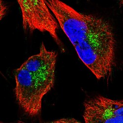 Invitrogen ENTH Polyclonal Antibody 100 &mu;L; Unconjugated:Antibodies,