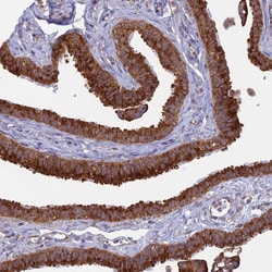 Invitrogen ENTH Polyclonal Antibody 100 &mu;L; Unconjugated:Antibodies,