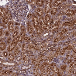 Invitrogen ENTH Polyclonal Antibody 100 &mu;L; Unconjugated:Antibodies,