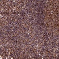 Invitrogen ENTH Polyclonal Antibody 100 &mu;L; Unconjugated:Antibodies,