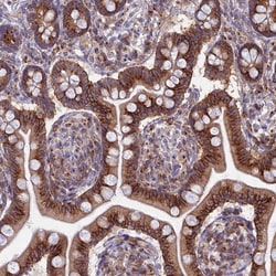 Invitrogen ENTH Polyclonal Antibody 100 &mu;L; Unconjugated:Antibodies,