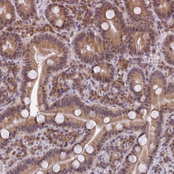 Invitrogen PEX16 Polyclonal Antibody 100 &mu;L; Unconjugated:Antibodies,