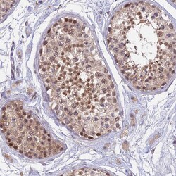 Invitrogen PEX16 Polyclonal Antibody 100 &mu;L; Unconjugated:Antibodies,
