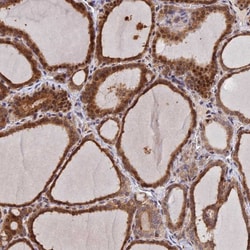 Invitrogen UFSP2 Polyclonal Antibody 100 &mu;L; Unconjugated:Antibodies,