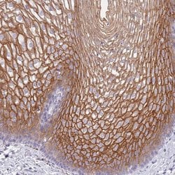 Invitrogen RHCG Polyclonal Antibody 100 &mu;L; Unconjugated:Antibodies,