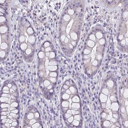 Invitrogen RHCG Polyclonal Antibody 100 &mu;L; Unconjugated:Antibodies,
