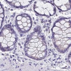 Invitrogen RHCG Polyclonal Antibody 100 &mu;L; Unconjugated:Antibodies,