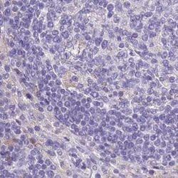 Invitrogen RHCG Polyclonal Antibody 100 &mu;L; Unconjugated:Antibodies,