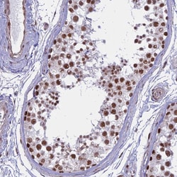 Invitrogen ALG10 Polyclonal Antibody 100 &mu;L; Unconjugated:Antibodies,