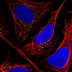 CLIP4 Polyclonal Antibody:Antibodies, Polyclonal