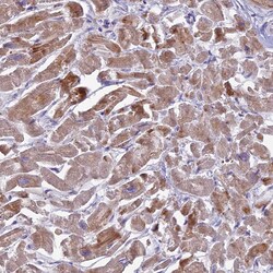 CLIP4 Polyclonal Antibody:Antibodies, Polyclonal