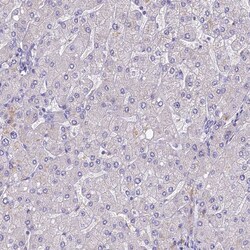 CLIP4 Polyclonal Antibody:Antibodies, Polyclonal