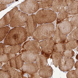 CLIP4 Polyclonal Antibody:Antibodies, Polyclonal