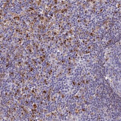Invitrogen HIC1 Polyclonal Antibody 100 &mu;L; Unconjugated:Antibodies,