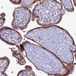 Invitrogen HIC1 Polyclonal Antibody 100 &mu;L; Unconjugated:Antibodies,