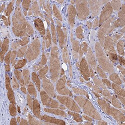 Invitrogen HIC1 Polyclonal Antibody 100 &mu;L; Unconjugated:Antibodies,