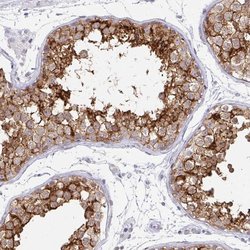 Invitrogen Doppel Polyclonal Antibody 100 &mu;L; Unconjugated:Antibodies,
