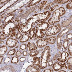Invitrogen HMX2 Polyclonal Antibody 100 &mu;L; Unconjugated:Antibodies,