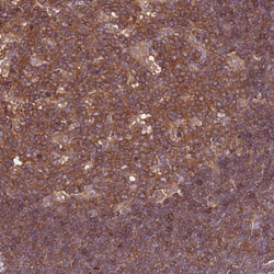 ATXN2L Polyclonal Antibody:Antibodies, Polyclonal
