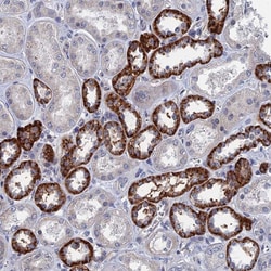 MARCH3 Polyclonal Antibody:Antibodies, Polyclonal