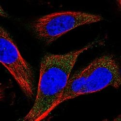 MARCH3 Polyclonal Antibody:Antibodies, Polyclonal